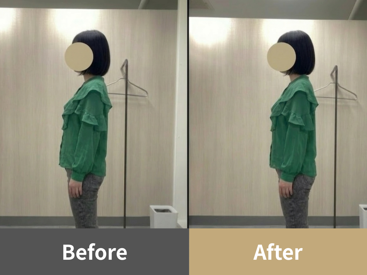 整体Cuoreの姿勢比較写真・症例2