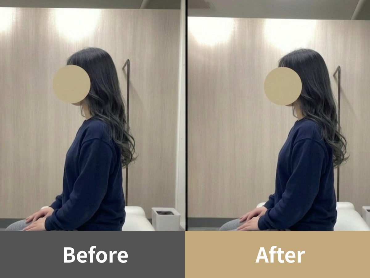整体Cuoreの姿勢比較写真・症例3