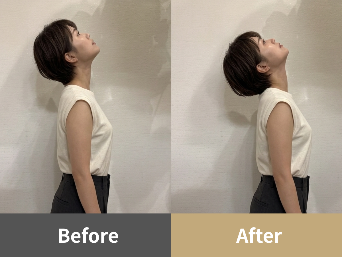 整体Cuoreの姿勢比較写真・症例4